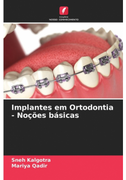 Implantes em Ortodontia - Noções básicas