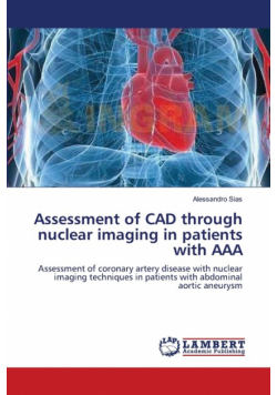 Assessment of CAD through nuclear imaging in patients with AAA