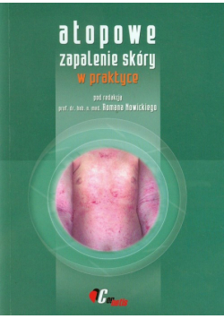 Atopowe zapalenie skóry w praktyce