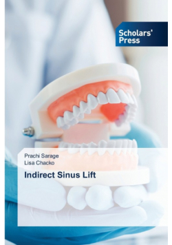 Indirect Sinus Lift