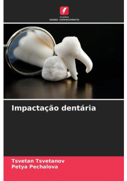 Impactação dentária