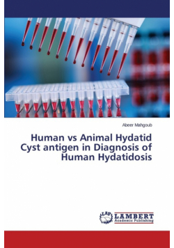 Human vs Animal Hydatid Cyst antigen in Diagnosis of Human Hydatidosis