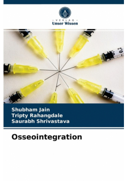 Osseointegration