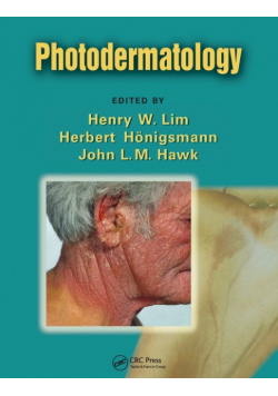 Photodermatology