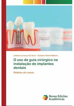 O uso de guia cirúrgico na instalação de implantes dentais