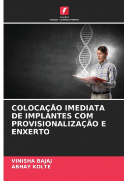 Colocação Imediata De Implantes Com Provisionalização E Enxerto