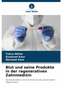 Blut und seine Produkte in der regenerativen Zahnmedizin