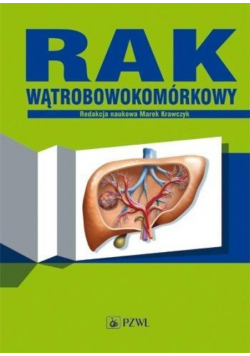 Rak wątrobowokomórkowy