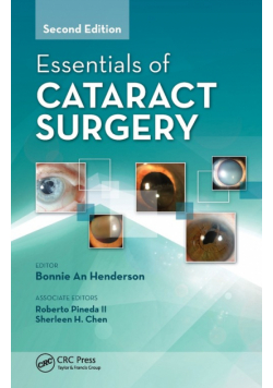 Essentials of Cataract Surgery