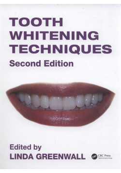 Tooth Whitening Techniques