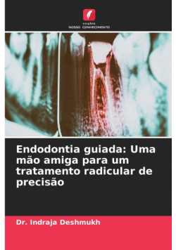 Endodontia guiada