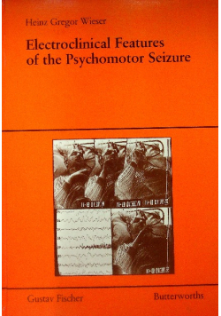 Electroclinical Features of the Psychomotor Seizure