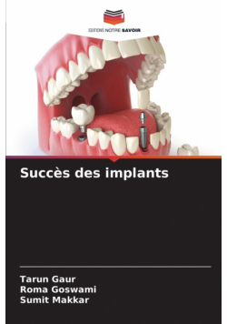 Succès des implants
