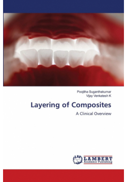 Layering of Composites