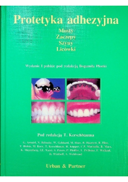 Protetyka adhezyjna Mosty Zaczepy Szyny Licówki