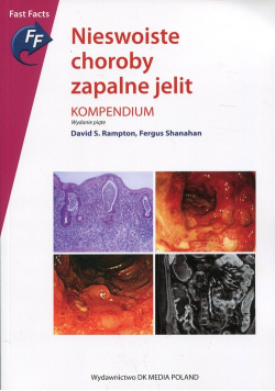 Nieswoiste choroby zapalne jelit Kompendium