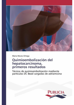 Quimioembolización del hepatocarcinoma, primeros resultados