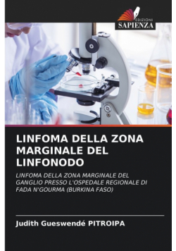 Linfoma Della Zona Marginale Del Linfonodo