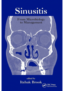 Sinusitis