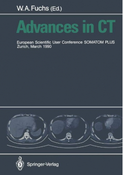 Advances in CT