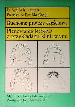 Ruchome protezy częściowe