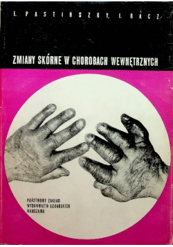 Zmiany skórne w chorobach wewnętrznych