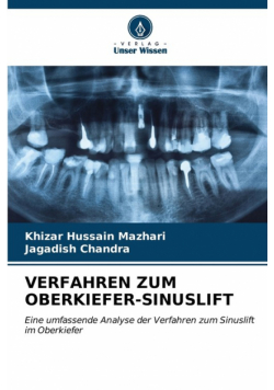Verfahren Zum Oberkiefer-Sinuslift