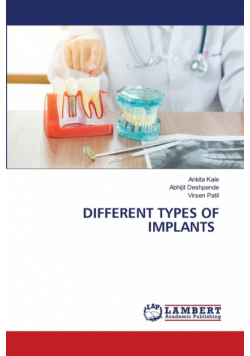 Different Types Of Implants