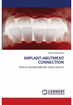 Implant-Abutment Connection