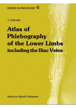 Atlas of Phlebography of the Lower Limbs
