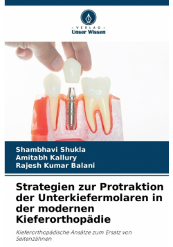 Strategien zur Protraktion der Unterkiefermolaren in der modernen Kieferorthopädie