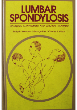 Lumbar Spondylosis