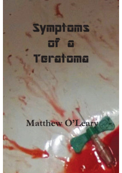 Symptoms of a Teratoma