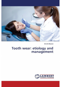 Tooth wear