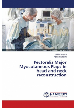 Pectoralis Major Myocutaneous Flaps in head and neck reconstruction