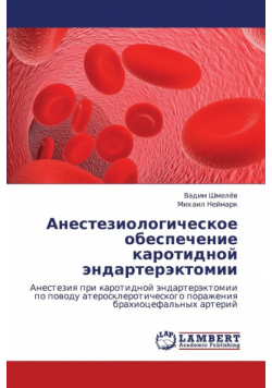 Anesteziologicheskoe Obespechenie Karotidnoy Endarterektomii