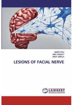 Lesions Of Facial Nerve