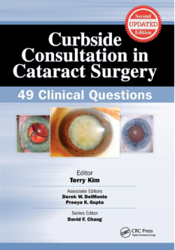 Curbside Consultation in Cataract Surgery