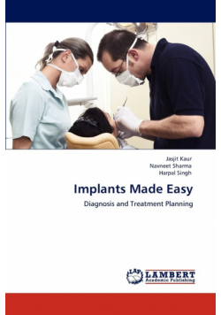 Implants Made Easy