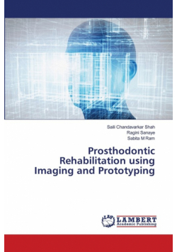 Prosthodontic Rehabilitation using Imaging and Prototyping