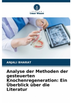 Analyse der Methoden der gesteuerten Knochenregeneration