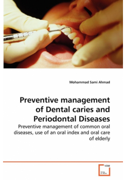 Preventive management of Dental caries and Periodontal Diseases