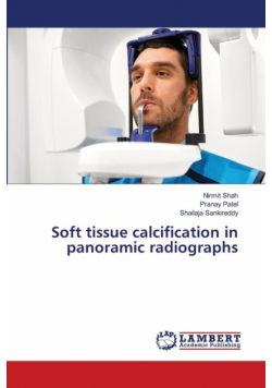 Soft tissue calcification in panoramic radiographs