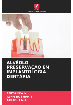 Alvéolo - Preservação Em Implantologia Dentária