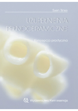 Uzupełnienia pełnoceramiczne