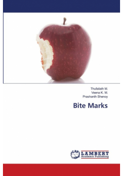 Bite Marks