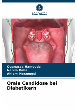 Orale Candidose bei Diabetikern