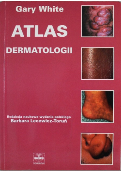 Atlas dermatolgii