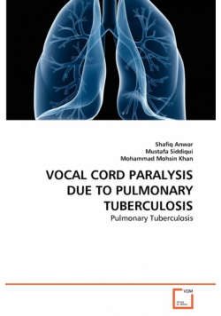 Vocal Cord Paralysis Due To Pulmonary Tuberculosis