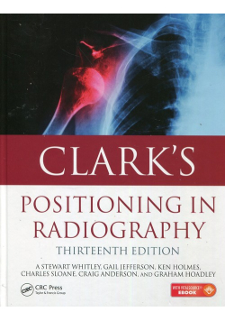 Clarks Positioning in radiography
